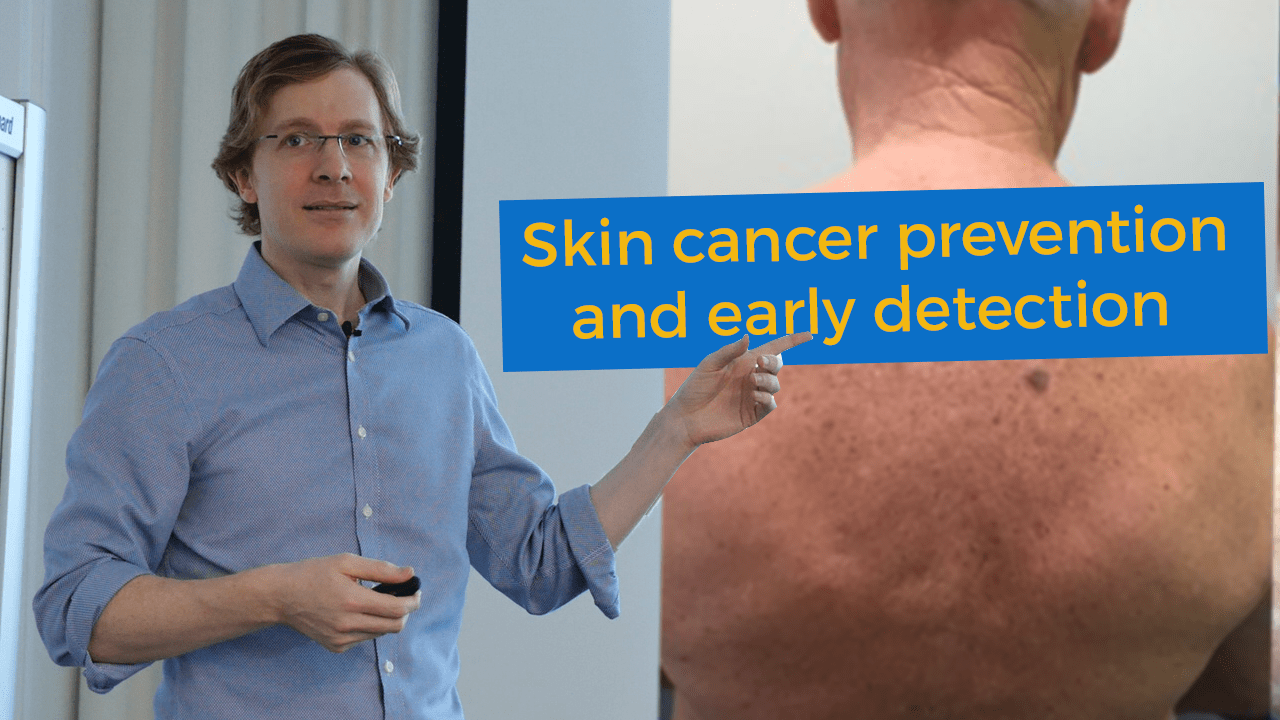 Sunburn and sunbeds Increasing your skin cancer risk